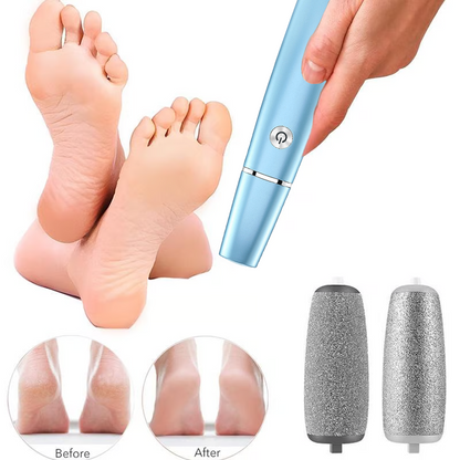 🔥Hot Sale - 50% UIT🔥Elektrische voeten eeltverwijderaar⚡